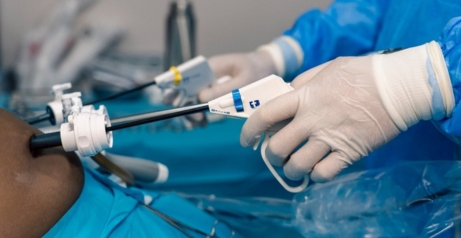 Laparoscopic Repair